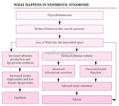 Nephrotic Syndrome Symptoms