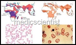 Hemoglobmopathies