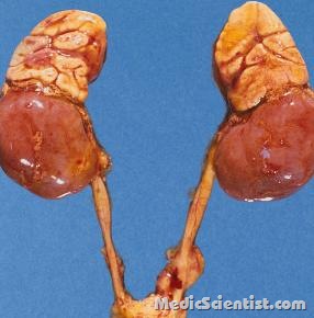 Adrenal Gland