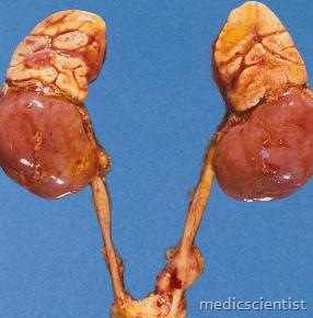 Adrenal Gland