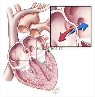 CONGENITAL HEART DISEASES 1