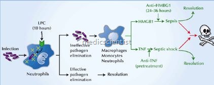 Sepsis (Septic Shock) 2