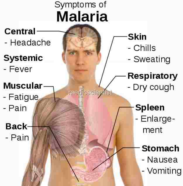 Clinical Features Symptoms malaris