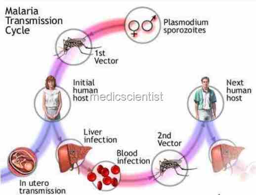 Liver dysfunction in malaria Hemolytic jaundice
