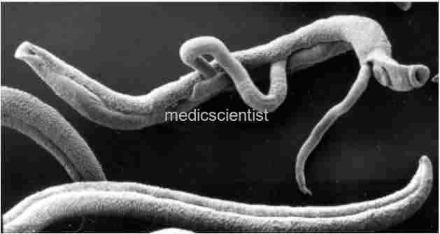 Schistosomiasis  Flat Worm