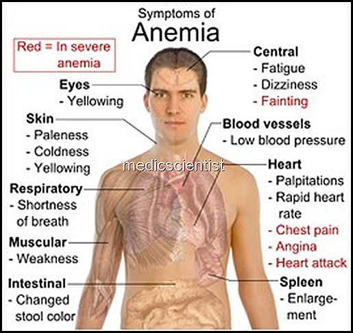 symptoms of anaemia