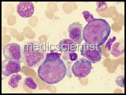 megaloblastic anemia -sickle cell anemia