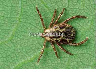 ROCKY MOUNTAIN SPOTTED FEVER e