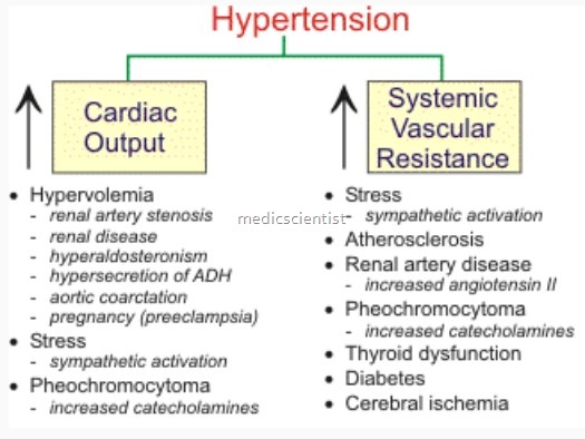 Hypertension Definition Classification - MedicScientist..