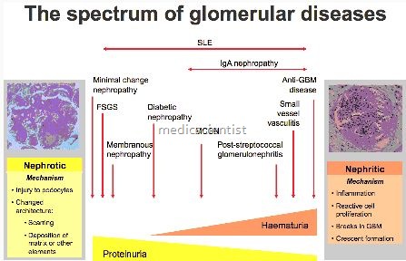 Glomerular Diseases 2
