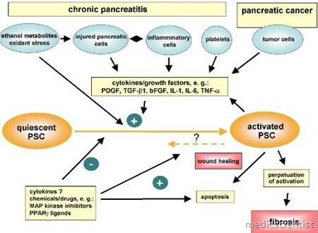 Chronic pancreatitis