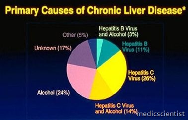 Drug Induced Hepatitis
