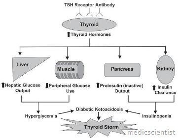 Thyrotoxic crisis or Thyroid storm