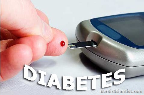 Diabetes mellitus Types,Causes,Symptoms and Diagnosis