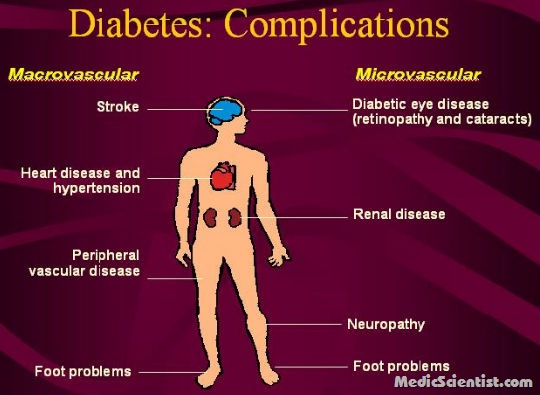 Chronic Complications Of Diabetes Mellitus 1